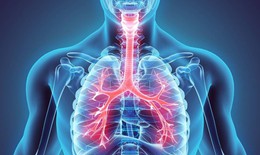 Nhận biết và đề phòng biến chứng nguy hiểm của khí phế thũng