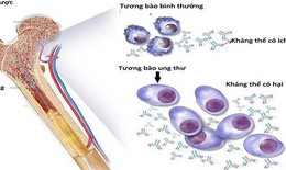 Th&#234;m liệu ph&#225;p điều trị đa u tủy xương t&#225;i ph&#225;t kh&#243; chữa