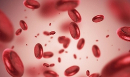 Thiếu máu ác tính: Triệu chứng khó nhận biết nhưng để biến chứng thì rất nguy hiểm