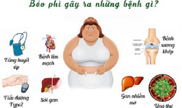 Chẩn đo&#225;n b&#233;o ph&#236; theo chỉ số BMI v&#224; điều trị bệnh b&#233;o ph&#236;