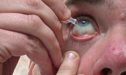 Phân biệt viêm kết mạc với viêm giác mạc