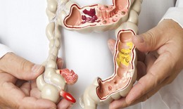 Liệu pháp cấy ghép phân lần đầu tiên được cấp phép trị nhiễm trùng do vi khuẩn