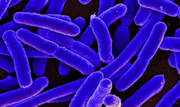 Vi khuẩn E.Coli không 'lành' như bạn vẫn nghĩ và 5 chìa khóa phòng ngộ độc thực phẩm
