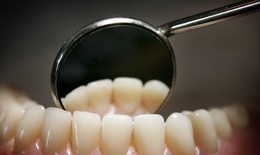 Sử dụng thuốc l&#225; điện tử tăng nguy cơ s&#226;u răng