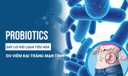 Đẩy l&#249;i rối loạn ti&#234;u h&#243;a do vi&#234;m đại tr&#224;ng mạn t&#237;nh