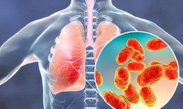 7 biện pháp phòng ngừa viêm phổi
