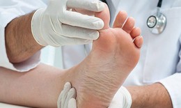7 bước quan trọng bảo vệ bàn chân ở người bệnh đái tháo đường trong mùa lạnh