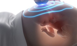 Khi nào mẹ bầu nên thực hiện siêu âm 4D?