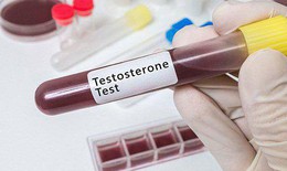 Mua testosterone tr&#234;n mạng, rủi ro hiện hữu