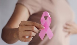 Tập thể dục giúp giảm tác dụng phụ của xạ trị trong điều trị ung thư vú