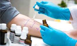 Vì sao cần test dị ứng thuốc kháng sinh penicillin?