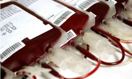 Năm 2022, Viện đầu ngành huyết học - truyền máu cung cấp gần 688.000 đơn vị chế phẩm máu tới 181 cơ sở y tế phía Bắc