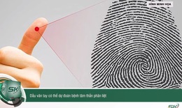Dấu vân tay có thể dự đoán bệnh tâm thần phân liệt