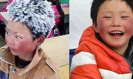 Cậu bé "người tuyết" từng làm hàng triệu trái tim thổn thức giờ ra sao sau 4 năm đầy biến động?