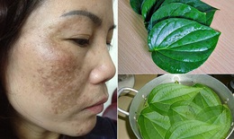 Có hay không tác dụng của lá trầu không chữa nám da? 