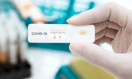 Bộ Y tế đề nghị sớm xem xét đưa kit test xét nghiệm COVID-19 vào diện bình ổn giá