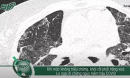 Nguy cơ phổi trắng xóa hậu COVID-19 dù là F0 không triệu chứng