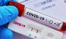 Nhu cầu xét nghiệm nhanh COVID-19 lên cao, chọn que test loại nào cho kết quả chính xác nhất?