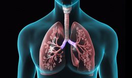 Xơ phổi hậu COVID khi nào bạn cần đi khám?