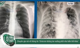 Thực hư thông tin 'biến thể Omicron không lan xuống phổi như biến thể khác'