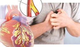 Nhận biết cơn đau tức ngực của bệnh mạch vành