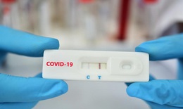 Bộ Y tế: Cơ sở kinh doanh phải niêm yết giá bán test xét nghiệm COVID-19; Xử lý nghiêm việc 'thổi' giá