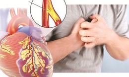 Làm sao kiểm soát bệnh mạch vành tại nhà?
