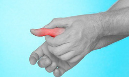7 nhận thức sai lầm trong điều trị bệnh gout cần tránh