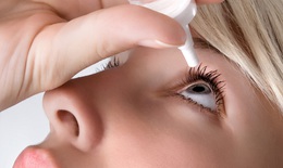 Dùng thuốc chữa dị ứng mắt 