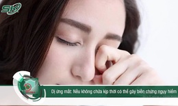 Dị ứng mắt: Không chữa kịp thời có thể gây biến chứng nguy hiểm