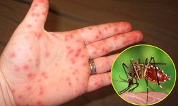 Những ca tử vong vì sốt xuất huyết gần đây do nguyên nhân nào?