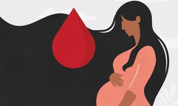 Chảy máu sau sinh: Dấu hiệu nào là bất thường?