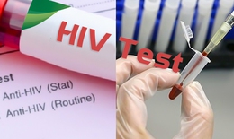 Can thiệp hỗ trợ phòng, chống HIV/AIDS trong các khu công nghiệp tại Đồng Nai