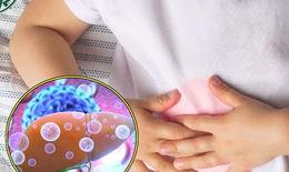 Chuyên gia nói gì khi nhiều phụ huynh đưa con đi kiểm tra viêm gan bí ẩn?