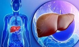 6 cách giúp thanh lọc cải thiện chức năng gan