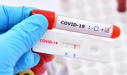 Hà Nội phát hiện 373 người mắc COVID-19
