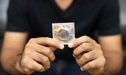 Bệnh đậu mùa khỉ có lây truyền qua đường tình dục?