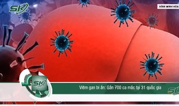 Viêm gan bí ẩn - gần 700 ca mắc tại 31 quốc gia