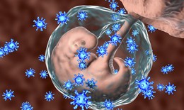 Phòng và điều trị virus viêm gan B truyền từ mẹ sang con
