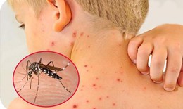 Đã có hơn 52.000 ca mắc sốt xuất huyết, 29 trường hợp tử vong: Bộ Y tế cảnh báo cao điểm mùa dịch