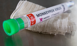 11 dấu hiệu và những cấp độ bệnh đậu mùa khỉ