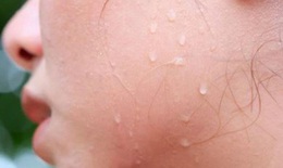 Ung thư tuyến mồ hôi: Triệu chứng, chẩn đoán và điều trị