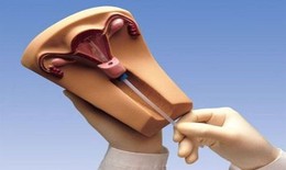 Lý giải 6 băn khoăn thường gặp về 'chuyện ấy' khi phụ nữ đặt vòng tránh thai