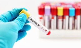Các thuốc kháng virus trị viêm gan B, những bất lợi cần lưu ý