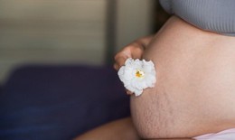 Ngăn ngừa rạn da khi mang thai thế nào cho an toàn, hiệu quả?