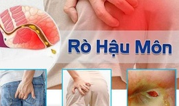 Rò trực tràng: Nguyên nhân, biểu hiện, biến chứng và điều trị