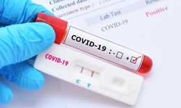 Ngày 8/6: Có 913 ca COVID-19 mới tại 43 tỉnh, thành; F0 nặng tăng lên 78 trường hợp