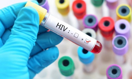 Người nhiễm HIV dễ bị lây nhiễm COVID-19 đột phá hơn