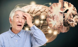 Thuốc tăng động có thể cải thiện triệu chứng của Alzheimer