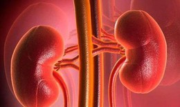 Bệnh suy thận mạn và cách hỗ trợ nhờ thảo dược